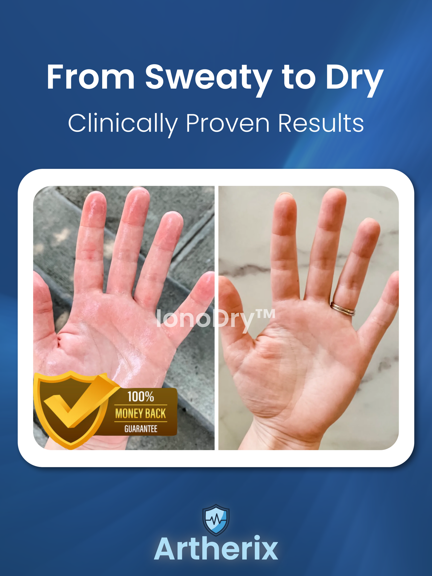 IonoDry™ Iontophoresis Machine | Sweat Control for Hands & Feet